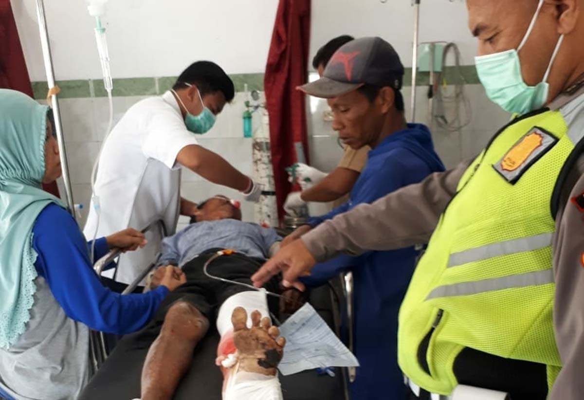 Petugas menunjukkan luka korban.