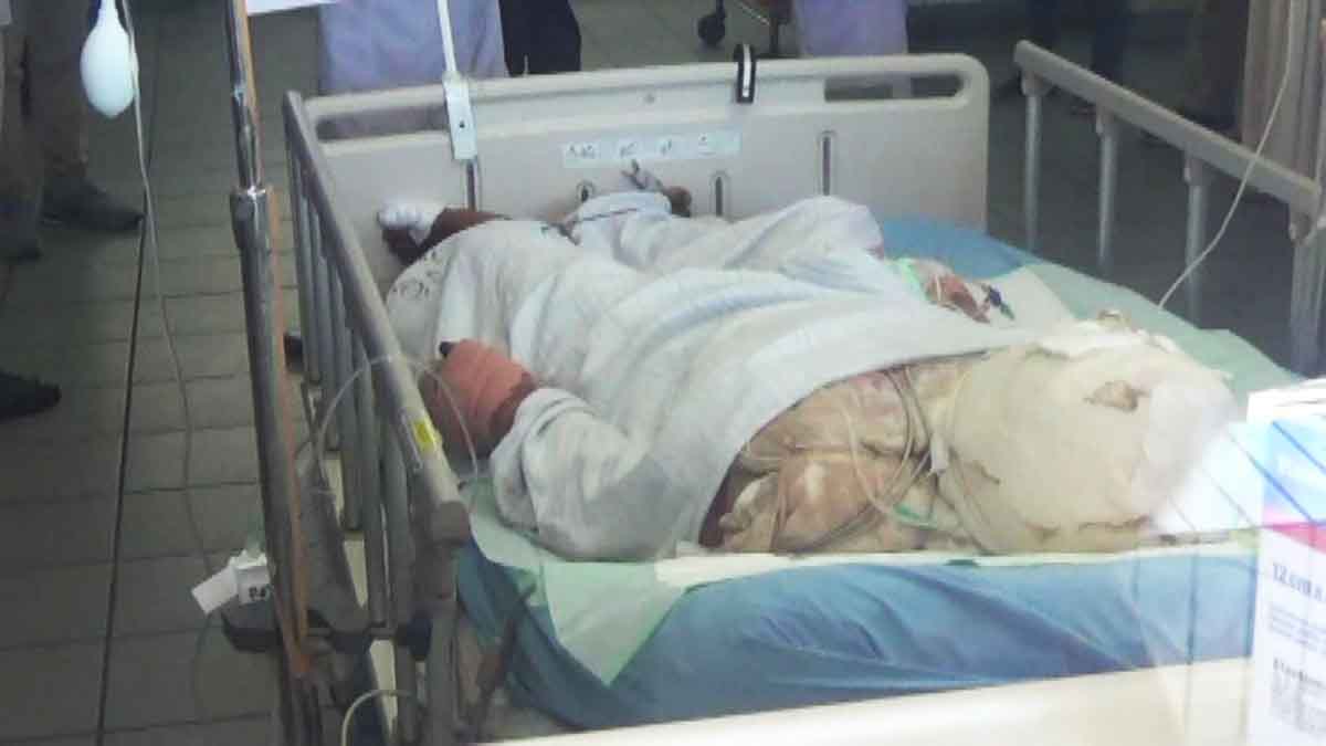 Kondisi terakhir Robi di ruang perawatan RSU dr Soetomo Surabaya.