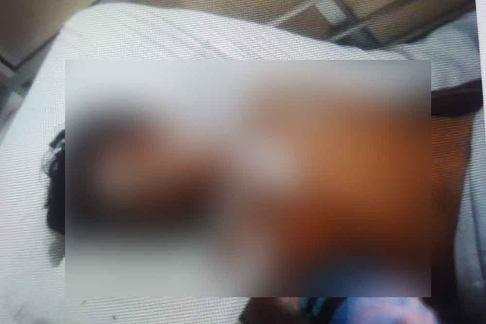 Supriyanto saat menjalani perawatan medis