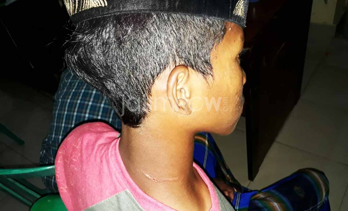 Korban dengan luka gores di leher akibat benda tajam jenis celurit