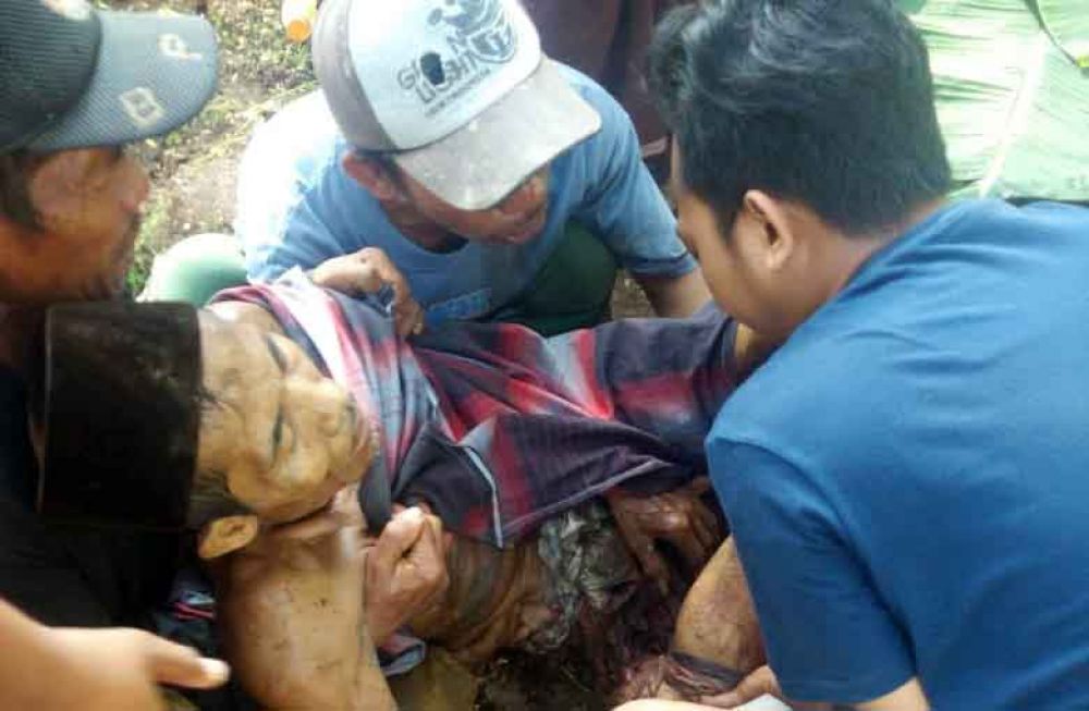 Korban pelemparan bom bondet di Pasuruan