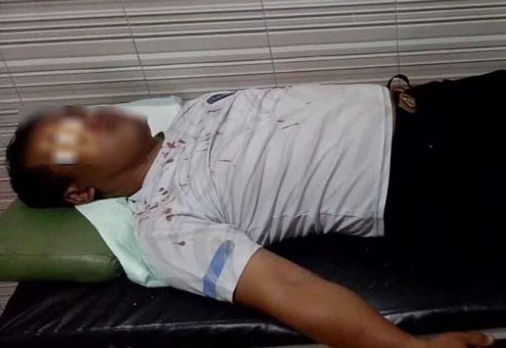 Korban, Bripka AA yang tengah mendapatkan perawatan