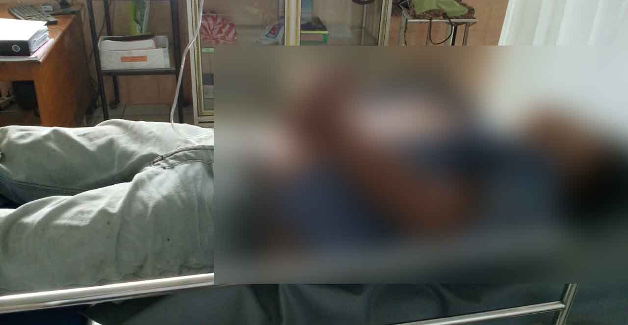 Tersangka saat dirawat di rumah sakit usai dihakimi warga.