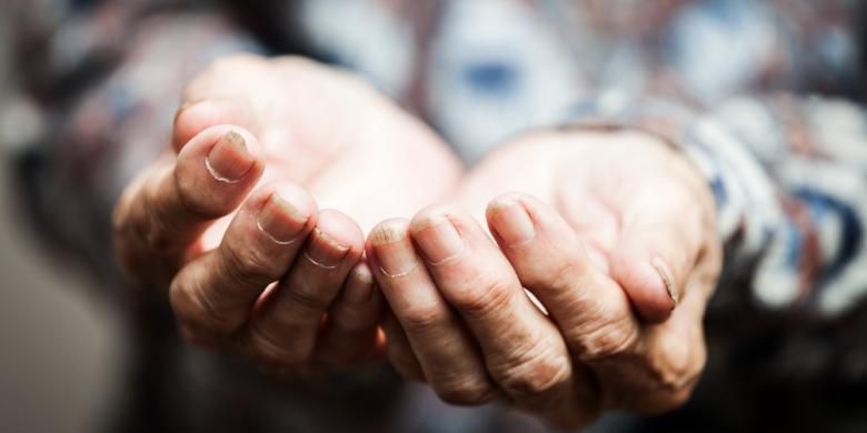 Pemkot: Gelandangan yang Ditemukan di Jakarta Bukan Warga Surabaya 