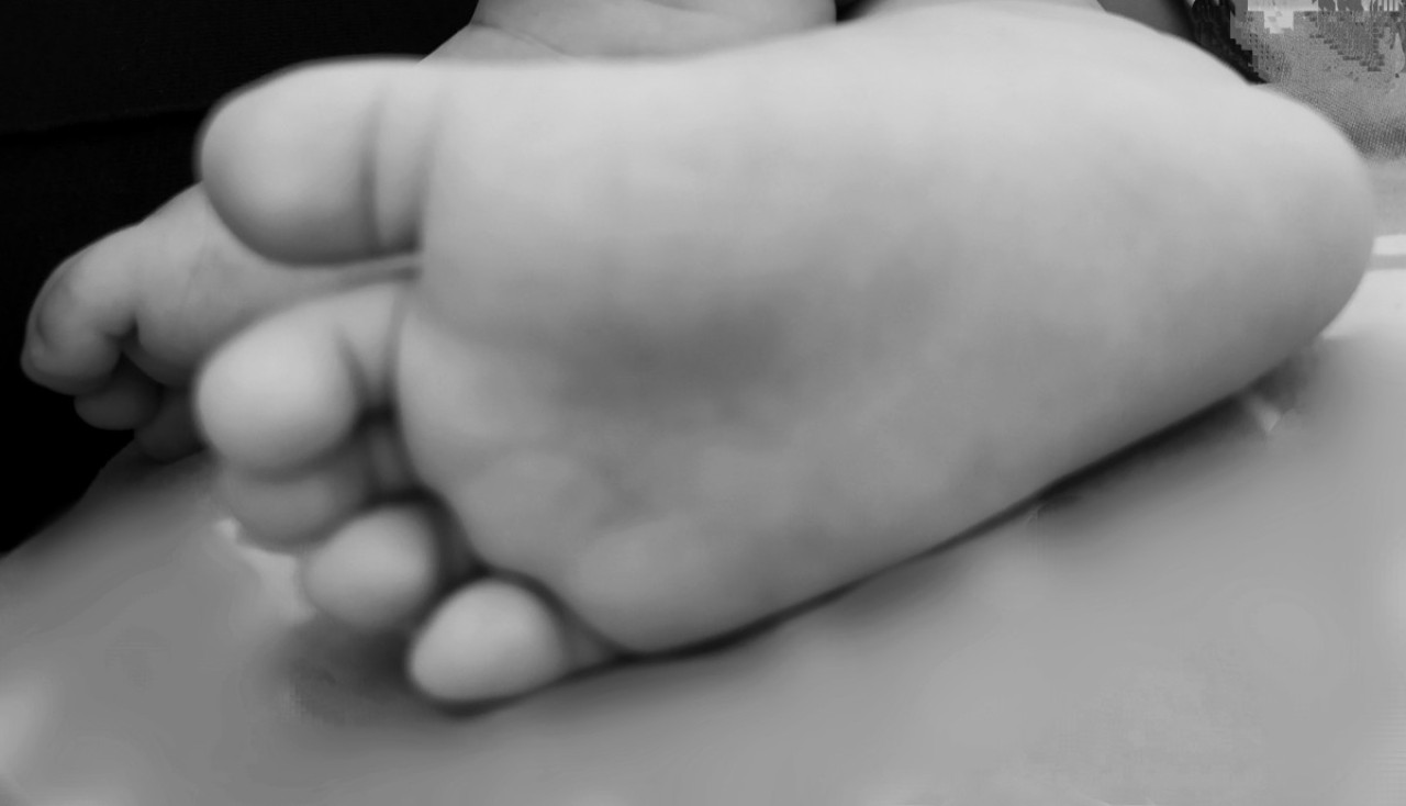 Balita di Gresik Tertimpa Alat Olahraga, Meninggal karena Pembuluh Darah Pecah