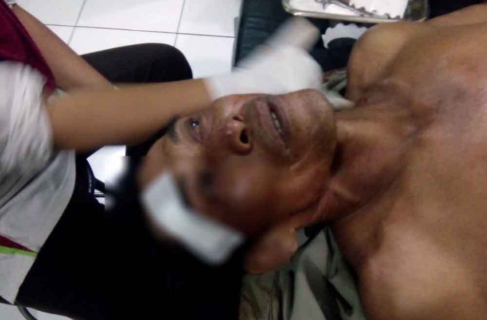 Korban menjalani perawatn usai dibacok