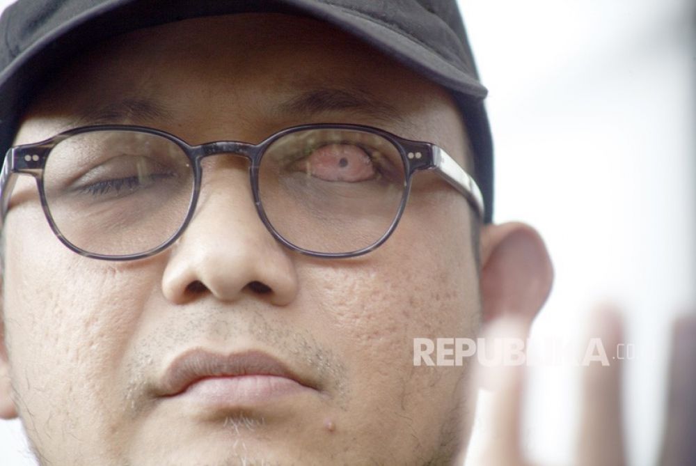 Penyidik KPK Novel Baswedan (Foto: Antara/Yulius Satria Wijaya)