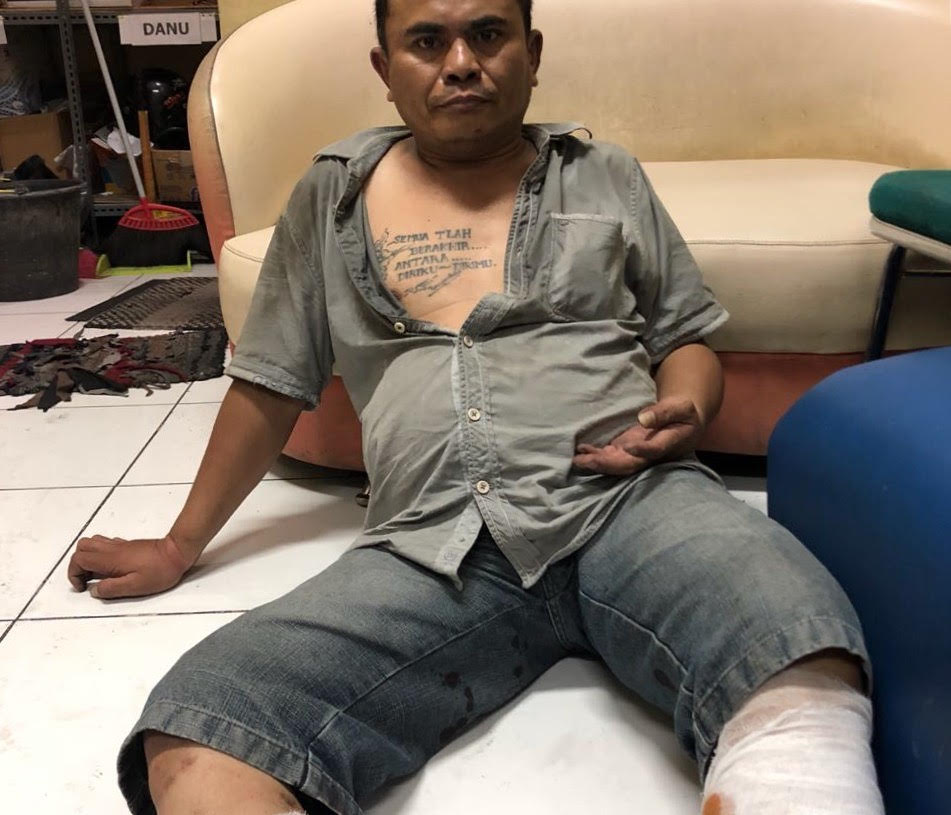 Samsudin, salah satu pelaku curas yang mendapat tindakan tegas dari Polrestabes Surabaya./Narendra Bakrie.